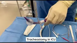 Percutaneous tracheostomy