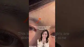 How Korean girls remove acne/tiny pimples/whiteheads 