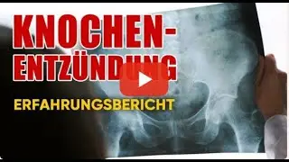 Tesla Oszillator als Unterstützung bei Knochenentzündung. Erfahrungsbericht