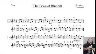 The Boys of Bluehill on the Aerophone AE20