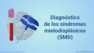 Diagnóstico de los síndromes mielodisplásicos (SMD)