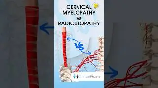 Cervical Radiculopathy vs Myelopathy 