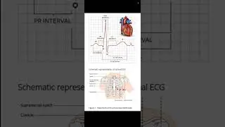 Indications of ECG