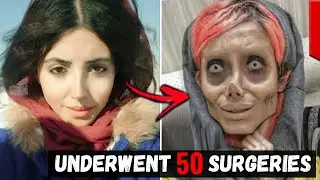 10 People Who Took Plastic Surgery Too Far...