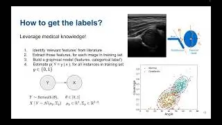 Technical Challenges of Machine Learning in Medicine - Roberto Vega