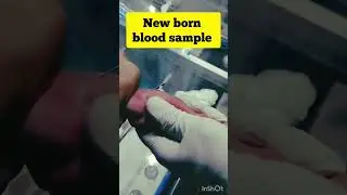 new born blood sample collection #dayinthelife #viral #doctorsvlog #medical #trending #vlog #medical