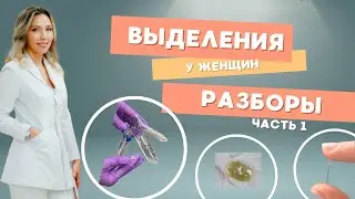 ВЫДЕЛЕНИЯ У ЖЕНЩИН. Разборы, часть 1.