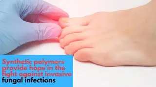 Medical Breakthrough-Synthetic polymers provide hope in the fight against invasive fungal infections