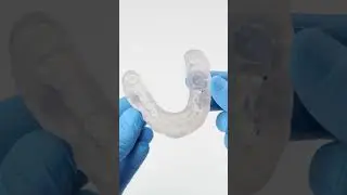 La Nouvelle Méthode Pour Poser Vos Bagues 🦷 #shorts #dental #orthodontist #3dprinting