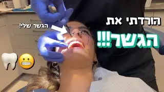 הורדתי את הגשר סוף סוף!