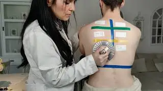 Allergic Reactions Testing On The Back - ASMR Allergy Check & Inspection