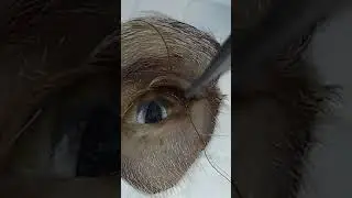 Temporary Tarsorrhaphy