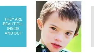 What You May Not Know About An Individual With Down Syndrome