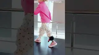 Девочка с укорочением ноги. Теперь она может бегать!