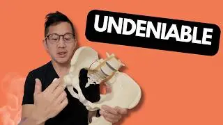 Two Laws of Hip Impingement and Hip Pain