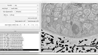 MoBIE: Exploring gene expression in Platynereis atlas