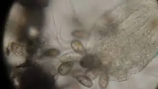 Coleps hirtus полная версия.