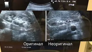 Ремонт узи датчиков - замена акустической линзы