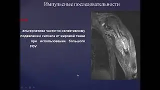 Базовый курс по МРТ  a  Лекция «МР анатомия плечевого сустава и методика сбора данных»  Учеваткин