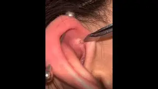 Tirando CRAVO da ORELHA 👂