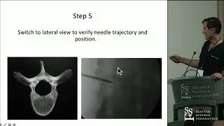 Approaches for Vertebral Augmentation - Douglas P. Beall, M.D.