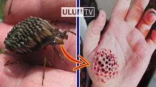 Don't Touch Them! 5 Most Dangerous and Deadly Insects in the World
