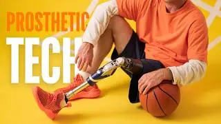 TOP 10 LIFE CHANGING ADVANTAGES OF PROSTHETIC TECHNOLOGY!