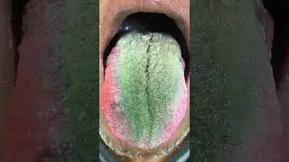 Что это? Что с этим языком не так? #shortsце #shots #чтоэто