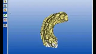 Cerec AC Anterior Optical Impression