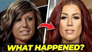 What Happened to Chelsea Houska’s Face