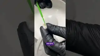 O que é o silano utilizado na cimentação de restaurações indiretas?! #dicasdeodonto #vidadedentista