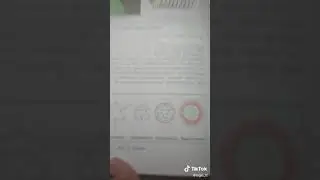 Короновирус давно известен !!!!