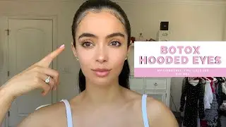 BOTOX- BEFORE AND AFTER - HOODED EYES- LIFT