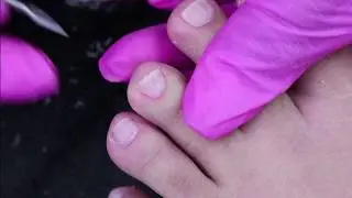 Preparação e cutilagem do pé, aula grátis de pedicure
