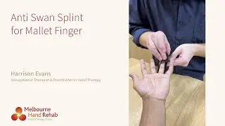 Anti Swan Splint for Mallet Finger