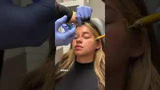 Non Surgical Nose Job! (Anyone else getting Topanga from boy meets world vibes?😍)