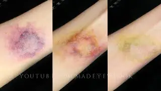 Bruise Makeup Tutorial | Special FX Series