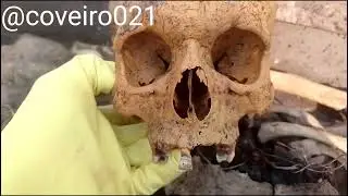 exumação somente o esqueleto #coveiro021