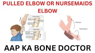 PULLED ELBOW OR NURSEMAID'S ELBOW - EPISODE 65