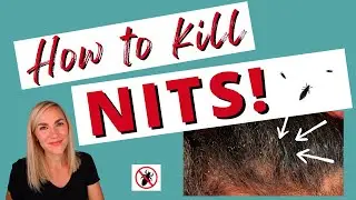 How to Kill Nits & Lice Eggs Tutorial