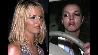 10 celebs after use of drugs |SHOCKING CHANGES|