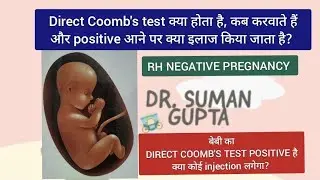 Rh Negative pregnancy मे Direct Coomb's test positive होने का क्या मतलब है, इसका क्या इलाज हे?