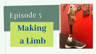 Episode 5: The Average Amputee | Making a New Limb