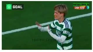 Manchester City's pre-season tour of the United States began with a 4-3 defeat to Celtic