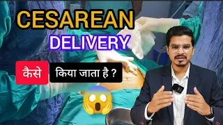 CESAREAN DELIVERY  कैसे किया जाता है ? / Dr. chandrashekhar verma (MBBS)