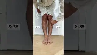 Гастрит 