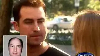 Apollo Hair ACR Tony Hair Loss and Hair Replacement
