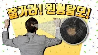 잘가라  원형탈모