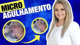 COMO FUNCIONA O MICROAGULHAMENTO NA PRÁTICA | LOURDES MESQUITA