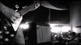SECOND CHANCE - Anesthetics